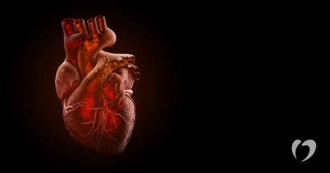 1-2018-June---Myocarditis.jpg