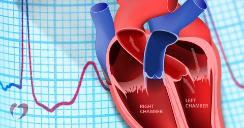 2017-October-Heart-Block-1.jpg