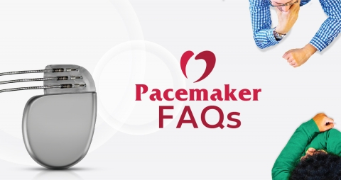 Pacemaker FAQs.jpg