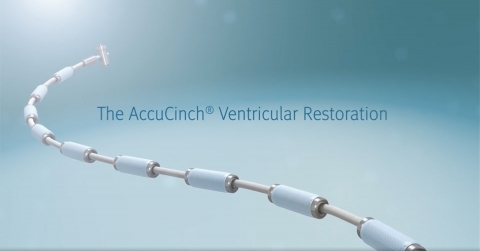 accucinch-ventricular-restoration-system-oklahoma-heart-hospital.jpg