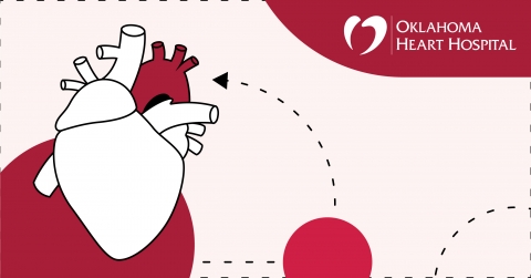 aortic-aneurysm-oklahoma-heart-hospital.jpg