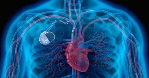 cardiac-resynchronization-therapy-crt-pacemakers-oklahoma-heart-hospital-new.jpg