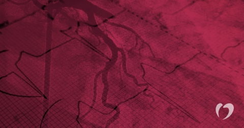 coronary-angiogram-oklahoma-heart-hospital.jpg