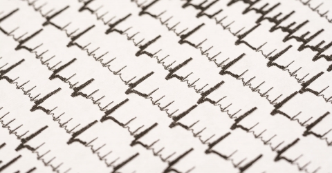 diagnosing-atrial-fibrillation-oklahoma-heart-hospital.jpg