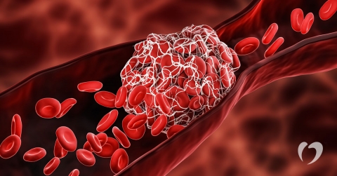 how-blood-clots-affect-the-body-oklahoma-heart-hospital.jpg