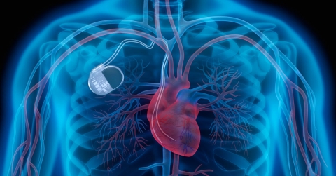 implantable-cardiac-devices-oklahoma-heart-hospital.jpg