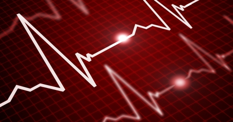 premature-contractions-oklahoma-heart-hospital.jpg