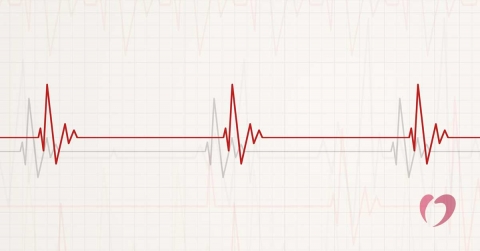 understanding-bradycardia-oklahoma-heart-hospital.jpg