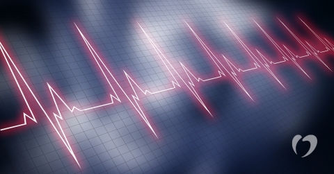understanding-sick-sinus-syndrome-oklahoma-heart-hospital.jpg