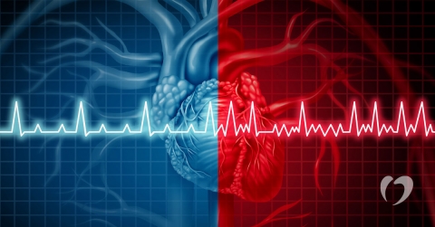 using-ablation-to-treat-premature-ventricular-contractions-oklahoma-heart-hospital.jpg