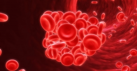 venous-thromboembolism-causes-symptoms-treatment-oklahoma-heart-hospital.jpg