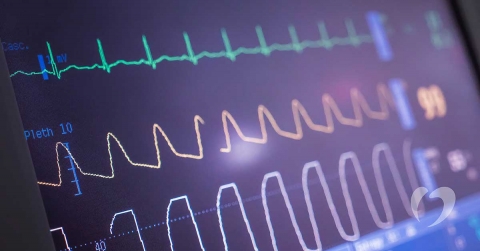 why-do-heart-rhythm-issues-happen-oklahoma-heart-hospital.jpg
